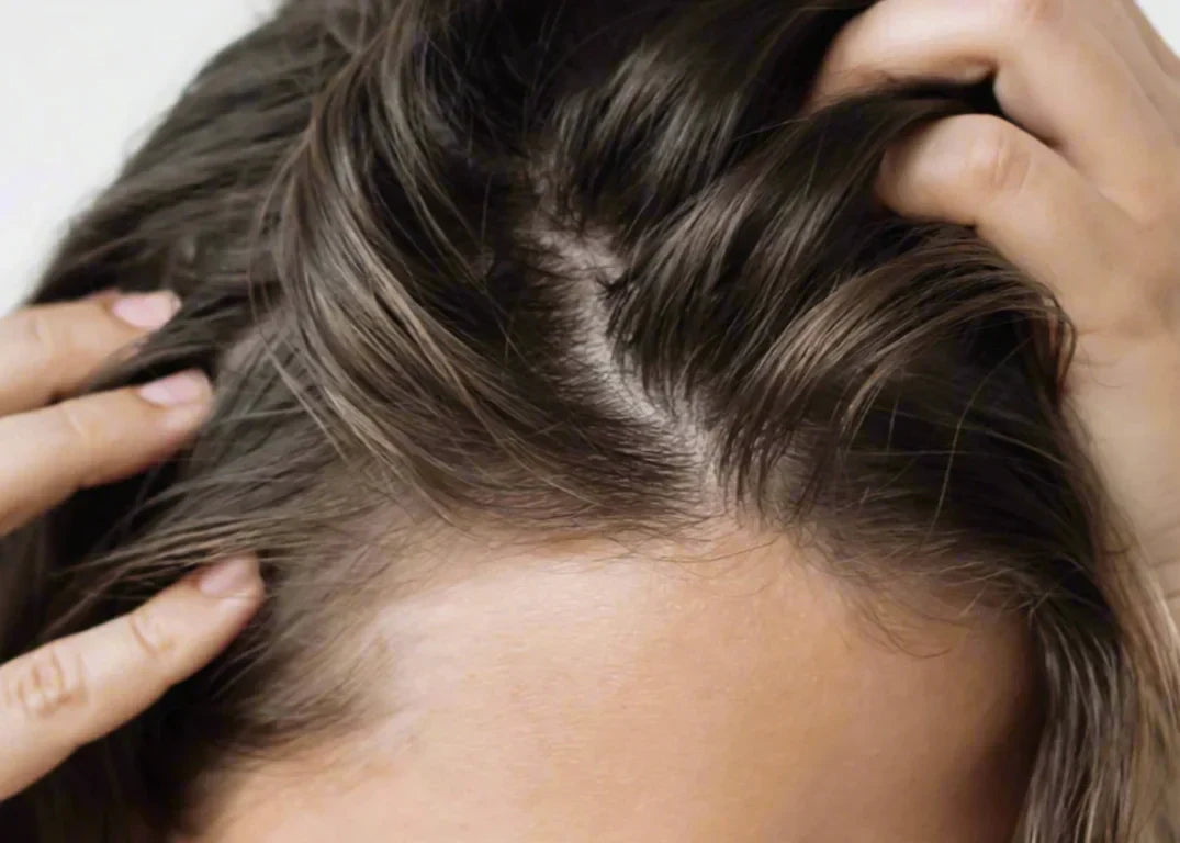 Fair-skinned woman with brown hair scratching scalp annoyed by flakes on grey background needing dandruff-fighting tips