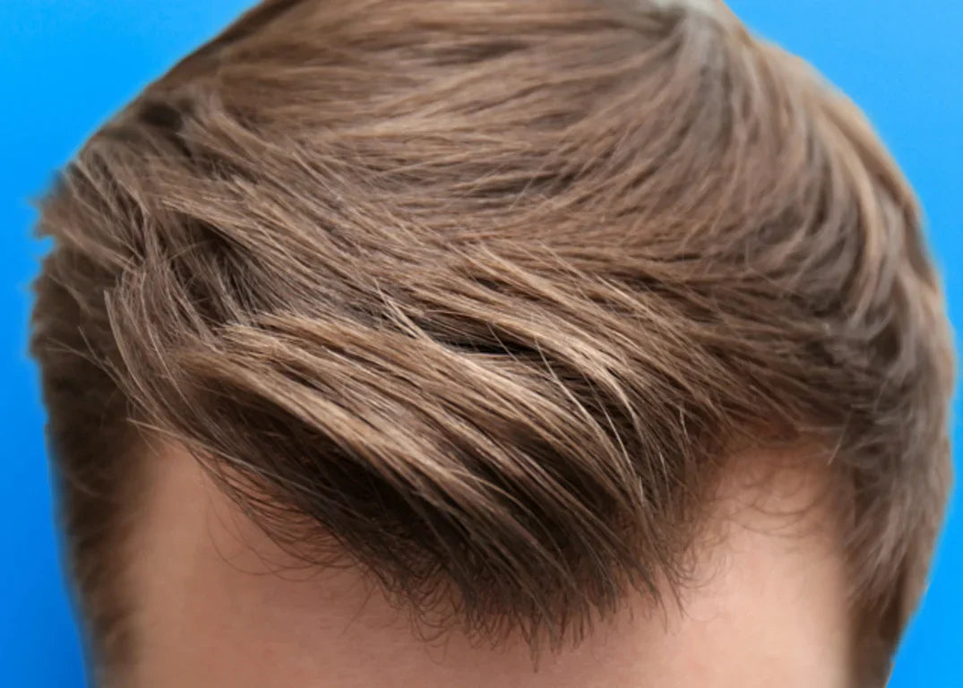 Fair skinned male with short brown hair styled as a combover is in front of a blue background
