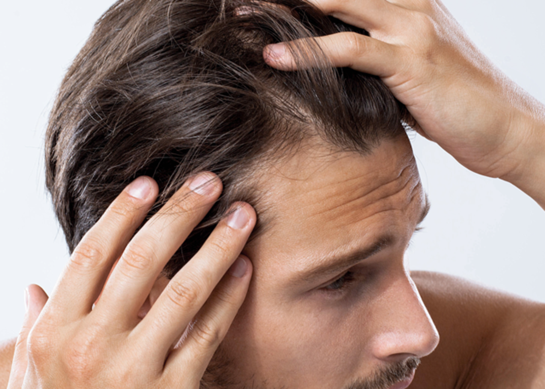 A man with fair skin and receding brown hair holds it back in his hands in front of a white background.